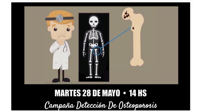 Campaña de detección de Osteoporosis Recibidos x